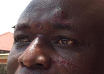 Ace Journalist Amin Lamptey physically attacked by Dreams FC Chief  Jiji Alifoe for ‘constantly criticizing’ Ghana FA President Kurt Okraku