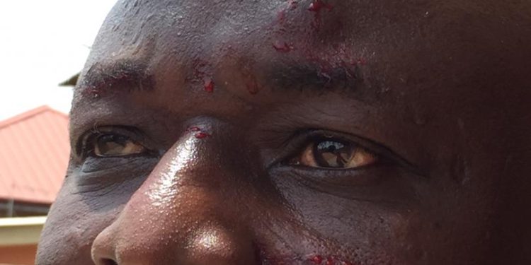 Ace Journalist Amin Lamptey physically attacked by Dreams FC Chief  Jiji Alifoe for ‘constantly criticizing’ Ghana FA President Kurt Okraku